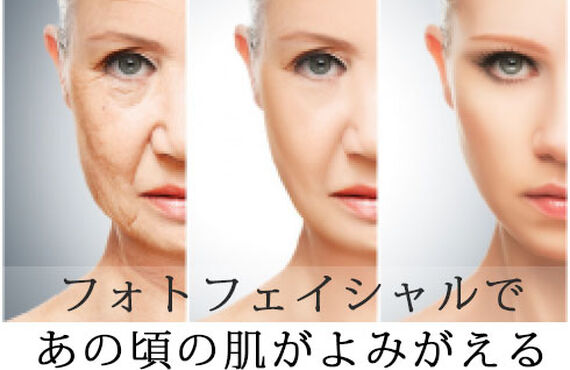 熊本川尻　しわ・たるみが気になる方に‼＜光フェイシャル＞